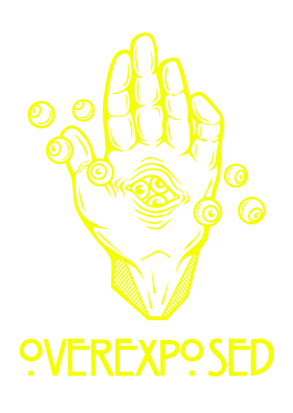 Overexposed