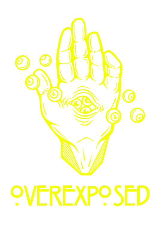 Overexposed